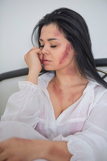 woman, bruise, abuse